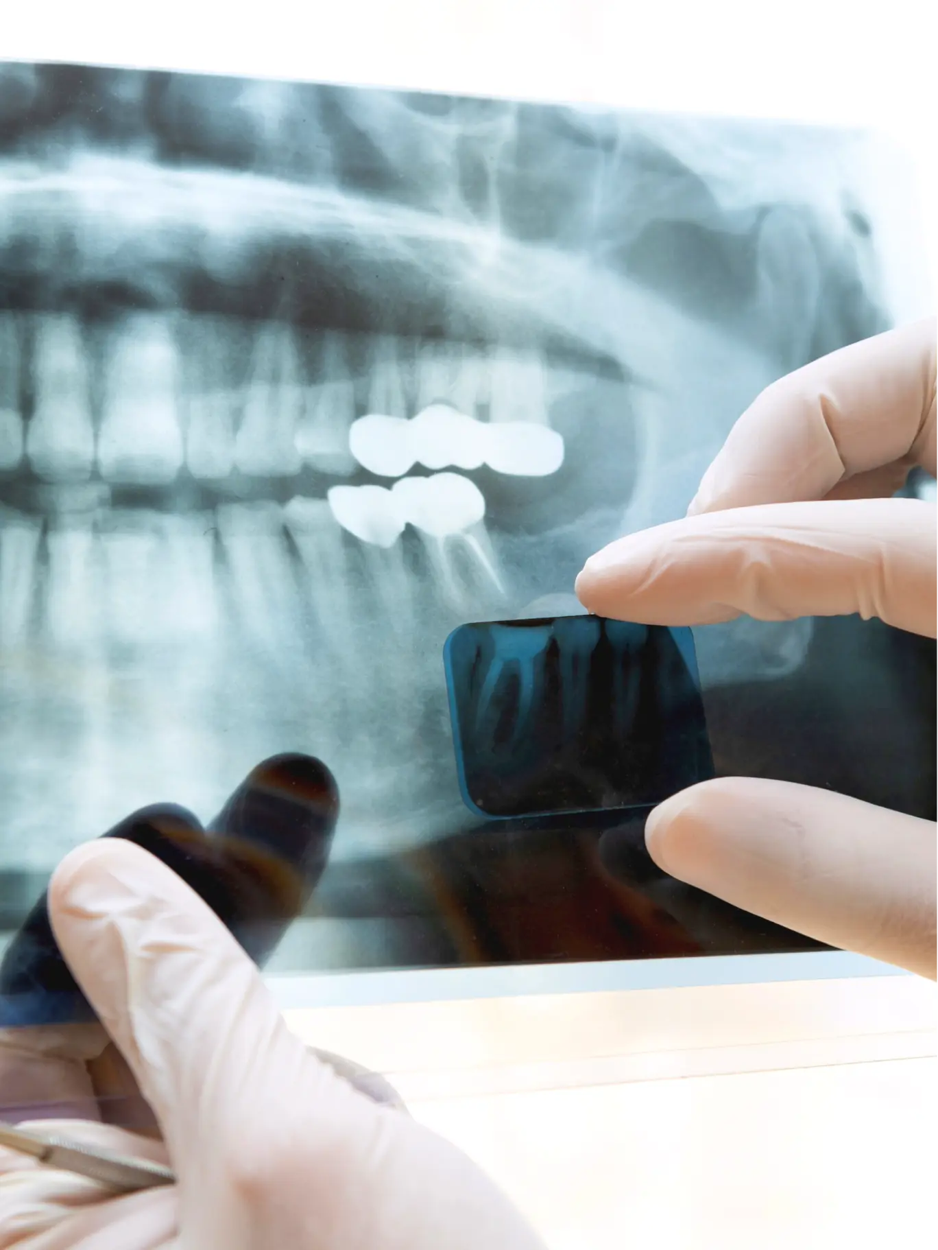 Endodoncia